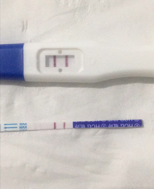 40歲還可以通過試管嬰兒生寶寶嗎？權(quán)威解答與注意事項(xiàng)